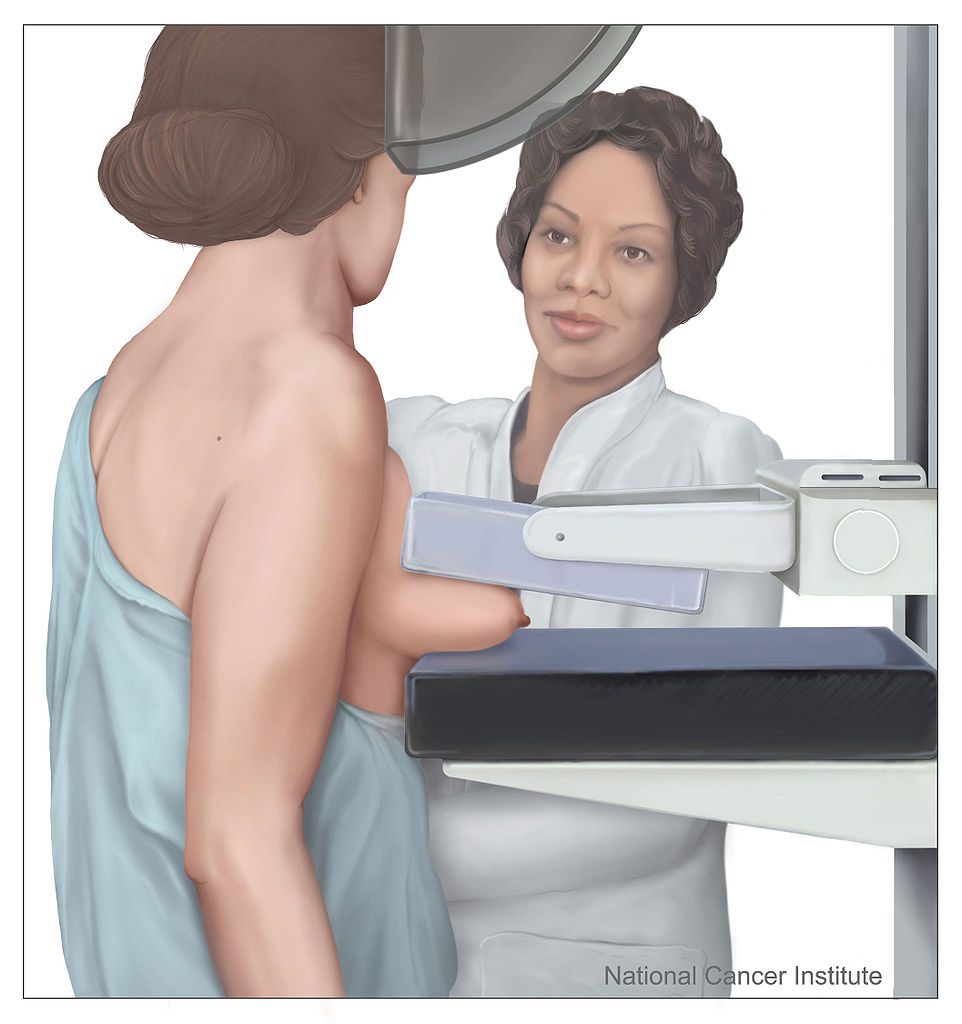 cost of mammogram in Nigeria