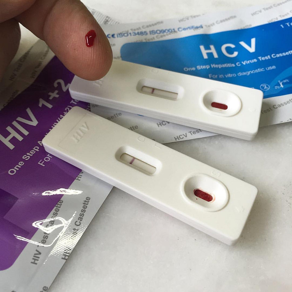 Lab tests for HIV Rapid test, CD4 count, & Viral Load