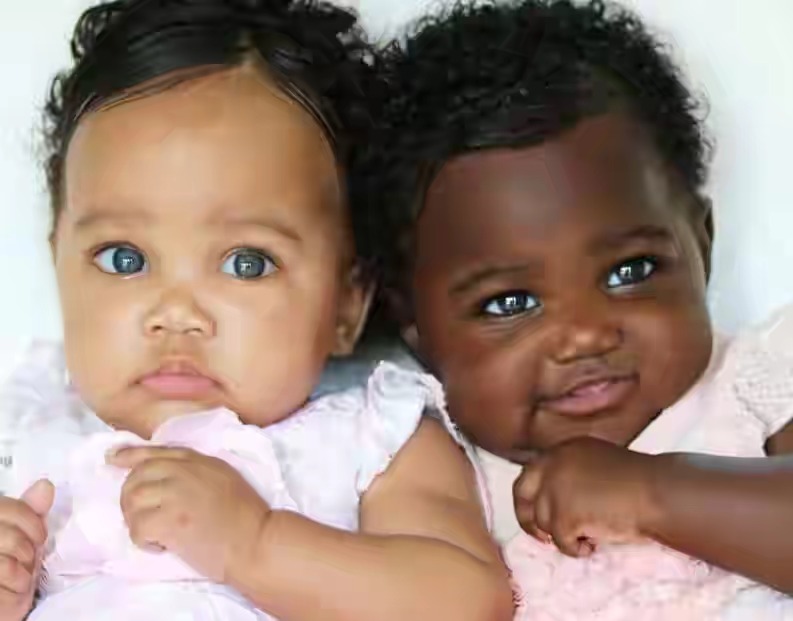 Heteropaternal Superfecundation: Twins From Different Fathers- Dr Casey ...