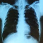How much does it cost to do X-ray in Nigeria