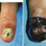 ESP0q5JXkAAq8lC 150x150