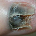 ESP0q5KXkAIkepR 150x150