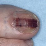 ESPuNWoWoAAhnt6 150x150