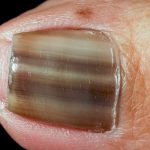 ESPv1PLXsAAU3Ol 150x150