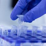 How much is coronavirus testing in Nigeria?