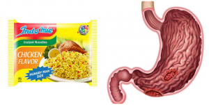 Can an Ulcer Patient Eat Noodles?