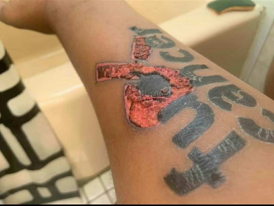 Inking the Skin What are the Benefits, Risks and Side effects of