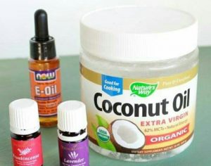 Stretch mark treatment in Nigeria: How to make stretch mark cream in Nigeria?