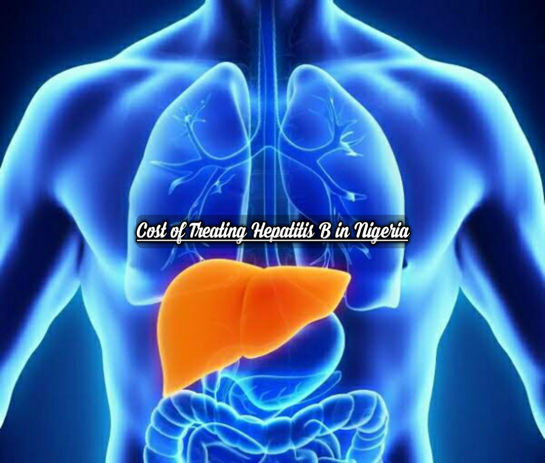 Cost of Treating Hepatitis B in Nigeria Cost of Treating Hepatitis B in Nigeria