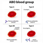 Most common blood group in Nigeria + Rarest blood group in Nigeria Most common blood group in Nigeria + Rarest blood group in Nigeria