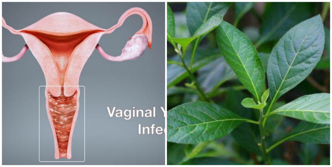 Can Bitter leaf cure yeast infection