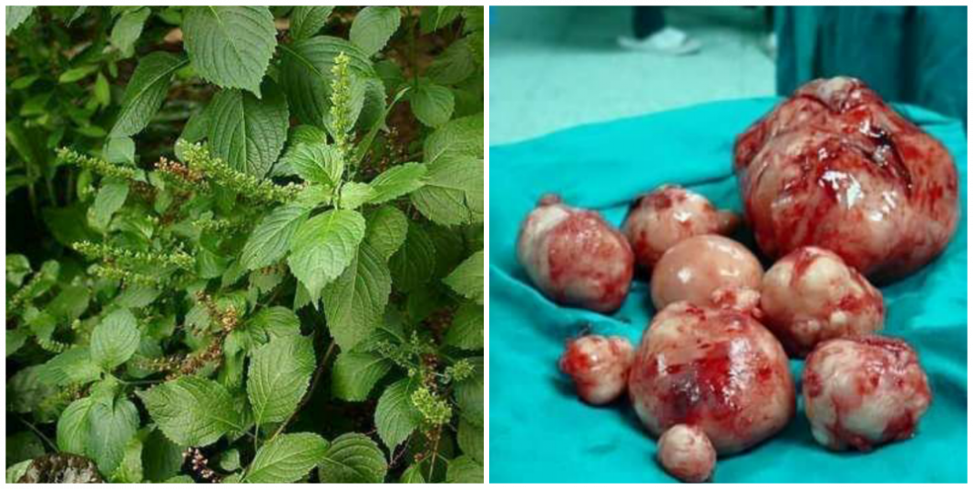 Sdoes scent leaf cure fibroids? Scent leaf and fibroid: does scent leaf cure fibroids?