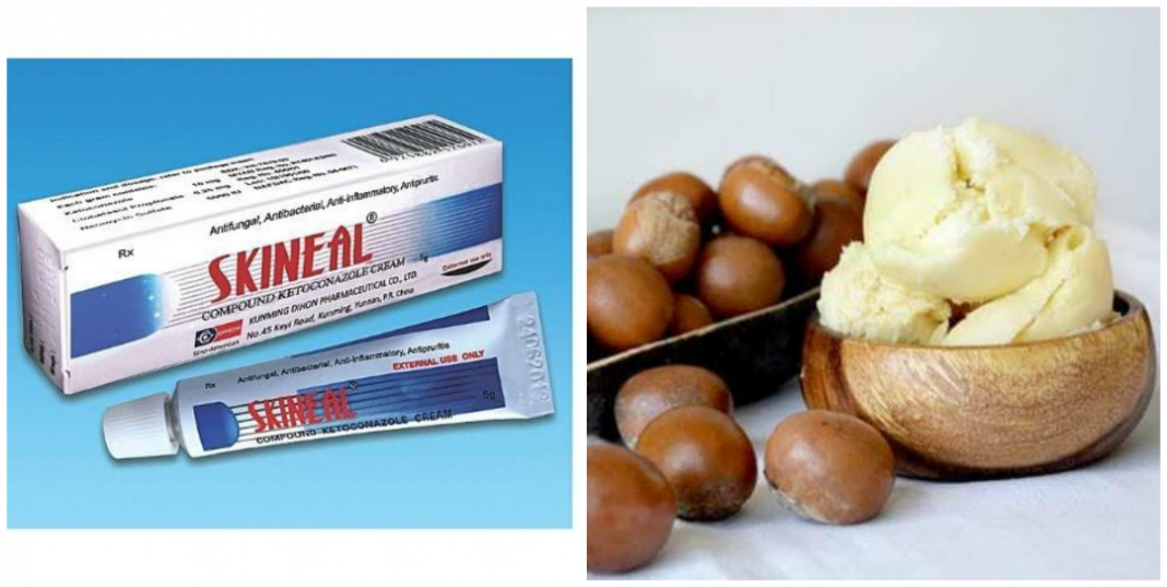 Can I mix Skineal with my body cream for bleaching, black spots, eczema