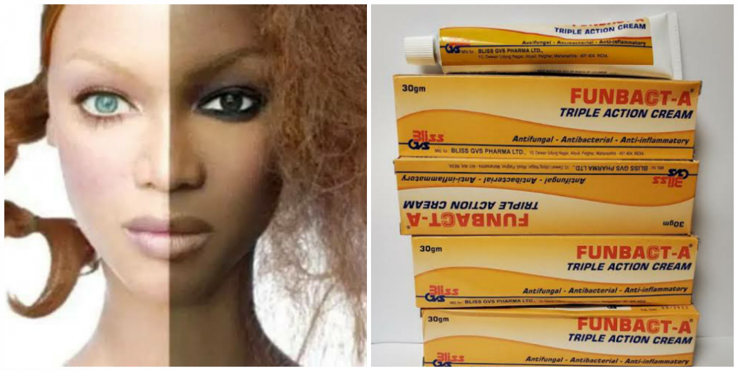 Is Funbact A bleaching cream? Is Funbact A bleaching cream?