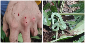 How long does it take to feel the effects of a snake bite?