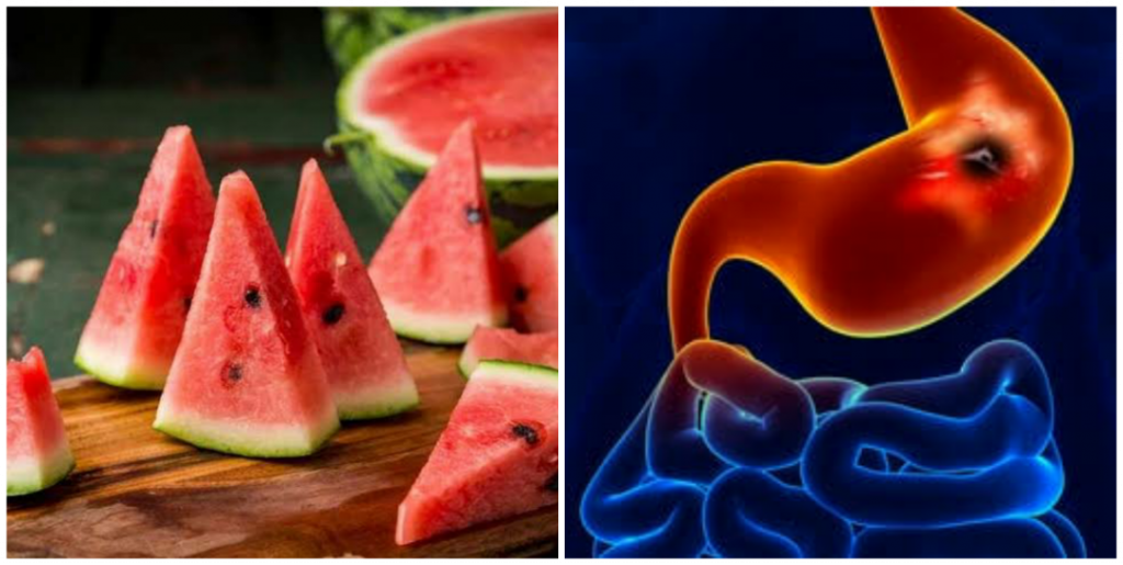 is-watermelon-good-for-ulcer-patient-nigerian-health-blog