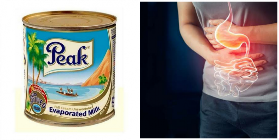 Is peak milk good for ulcer patient?