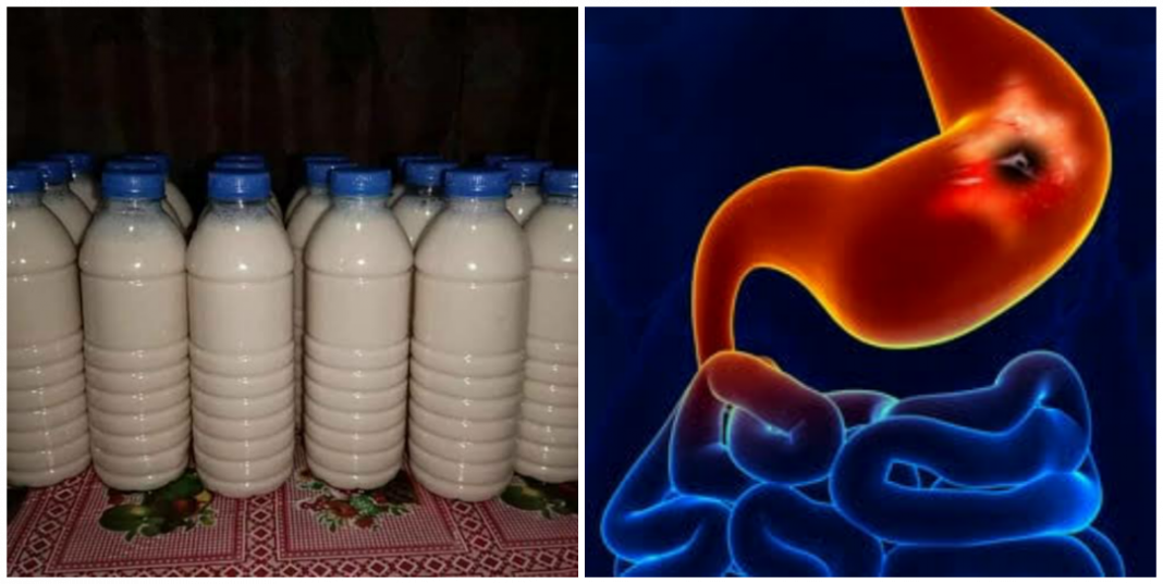 Is kunu good for ulcer patient? Is kunu good for ulcer patient?
