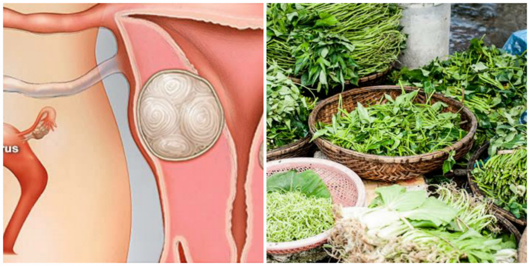 Yoruba herbal cure for fibroid Yoruba herbs for fibroid