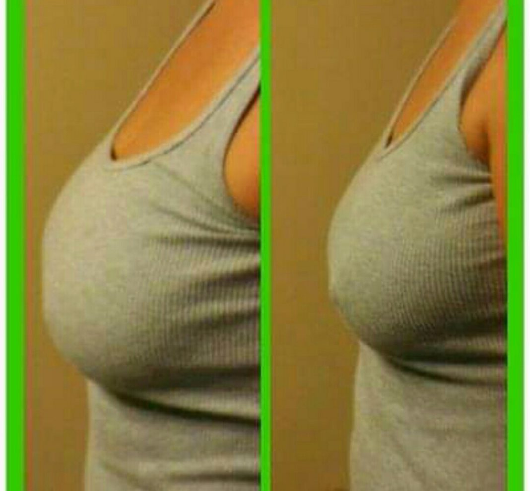 Cost of breast lift surgery in South Africa Cost of breast lift surgery in South Africa