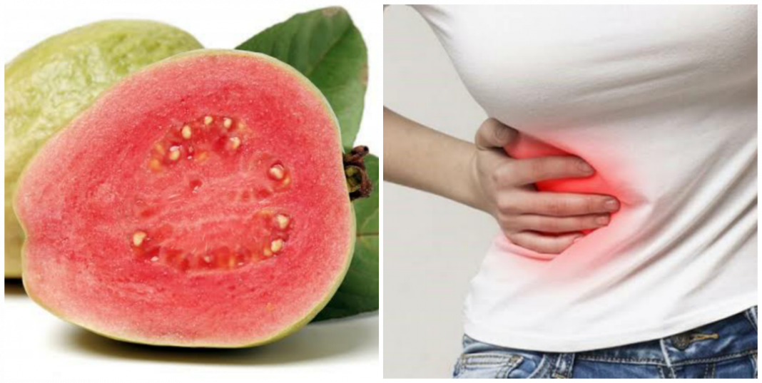 Do guava seed cause appendix/appendicitis