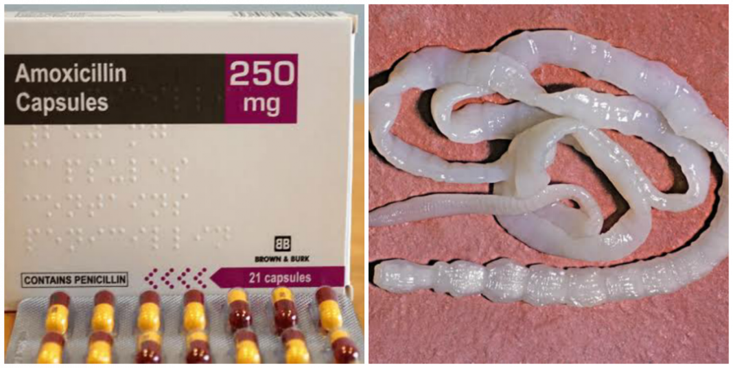 Does amoxicillin kill worms in humans Does amoxicillin kill worms in humans