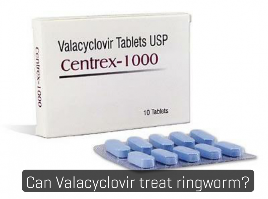 Can valacyclovir treat ringworm?