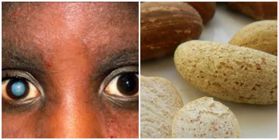 Can bitter kola cure cataracts eye problem