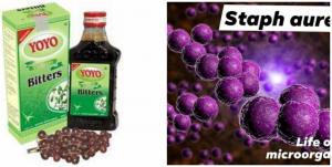 Can Yoyo bitters cure staph infection?