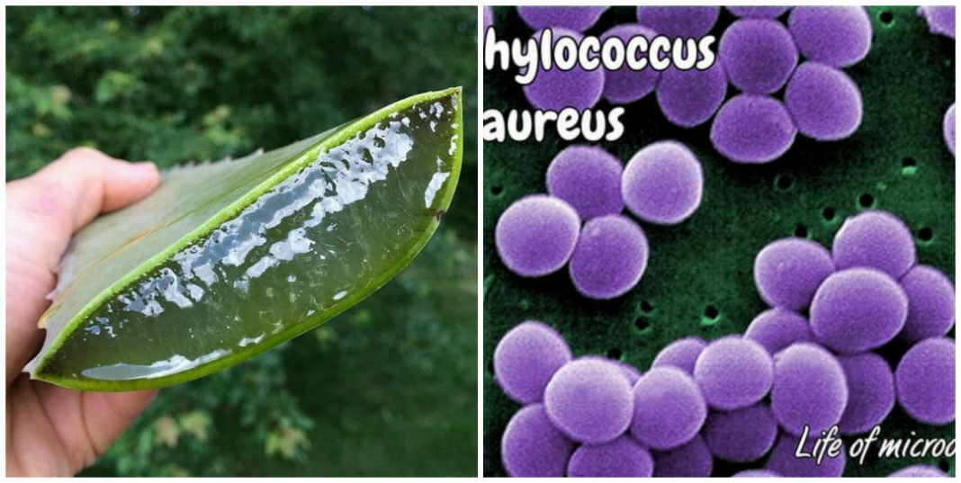 How to use Aloe vera to cure staph infection