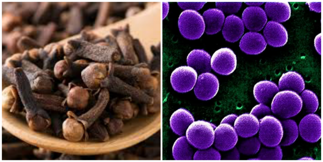 Can clove cure Staphylococcus Aureus Infection?
