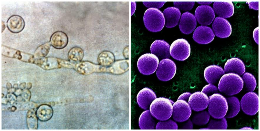 Difference between Candida and Staphylococcus
