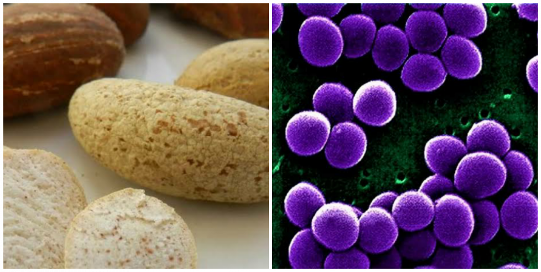 Can bitter kola cure Staphylococcus aureus?