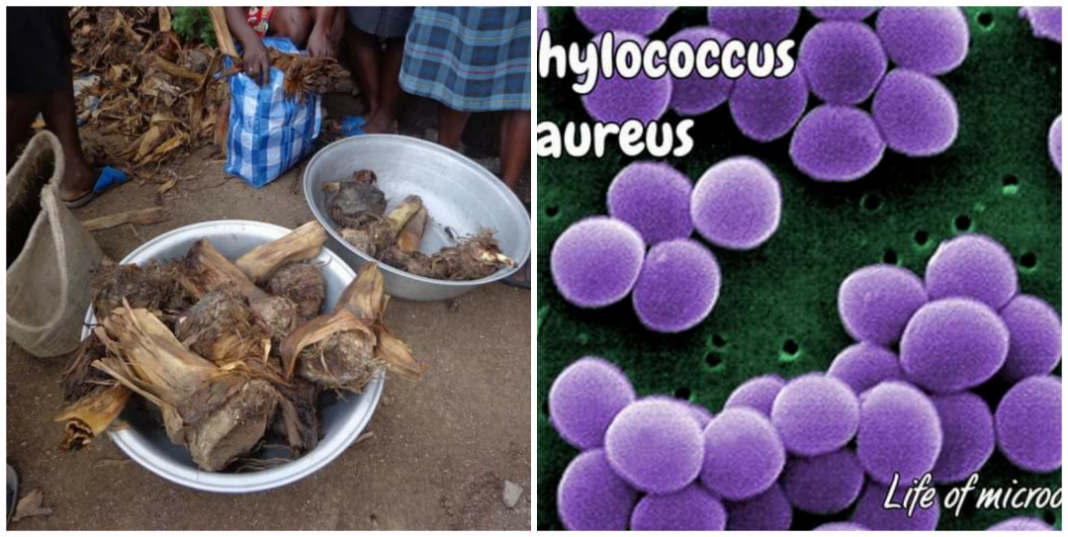 Can plantain root juice cure staphylococcus? Can plantain root juice cure staphylococcus?