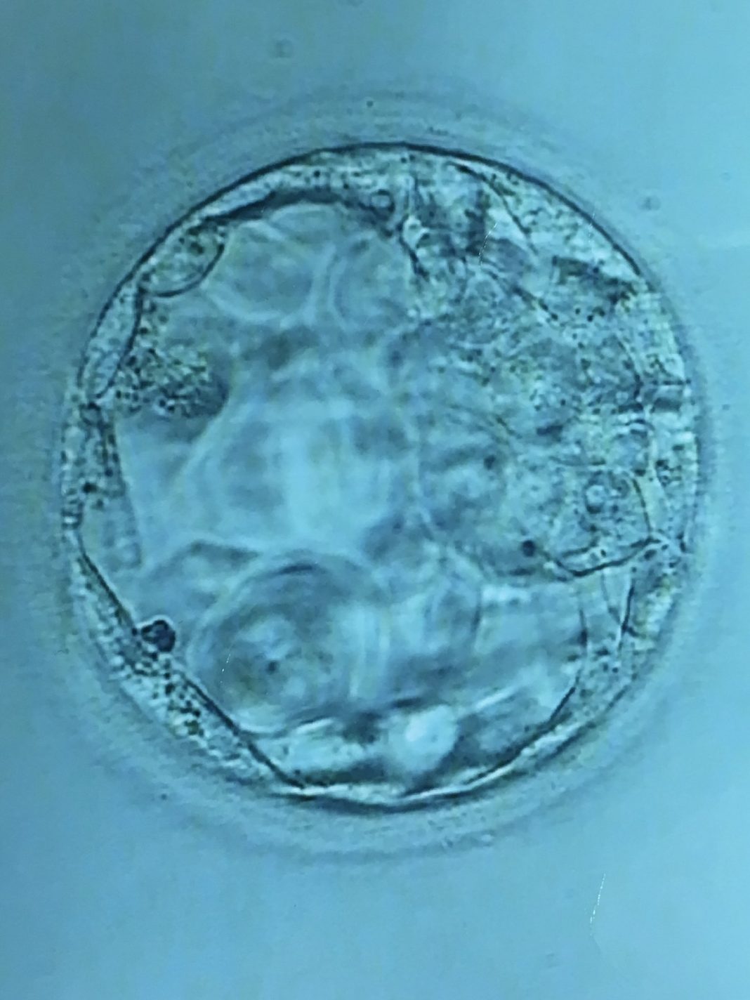 How much is IVF in Zambia