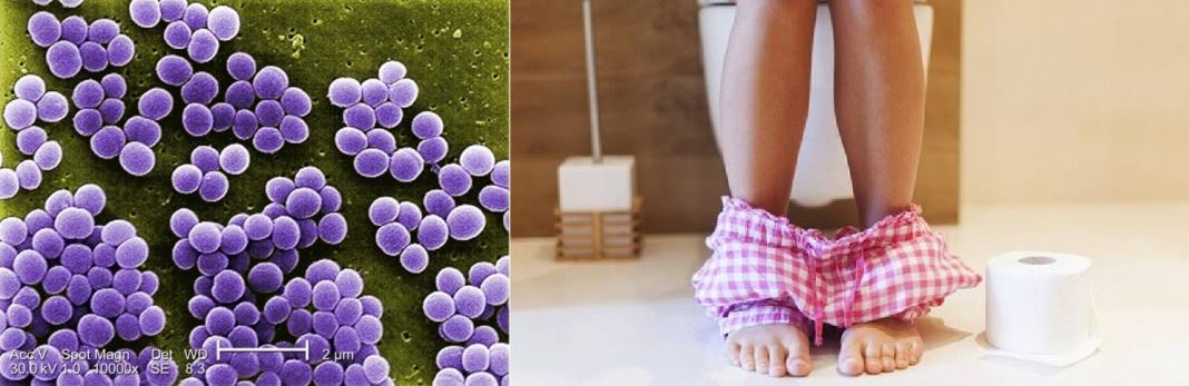 Is Staphylococcus a toilet infection