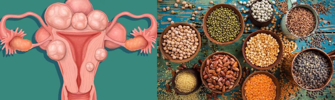 7 foods for shrinking fibroids