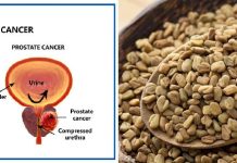 Fenugreek and Enlarged Prostate:Is fenugreek good for prostate cancer? Fenugreek and Enlarged Prostate:Is fenugreek good for prostate cancer?