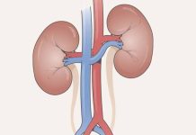 How to donate kidney legally in Nigeria for Money How to donate kidney legally in Nigeria for Money