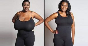 Why breast become loose after marriage?