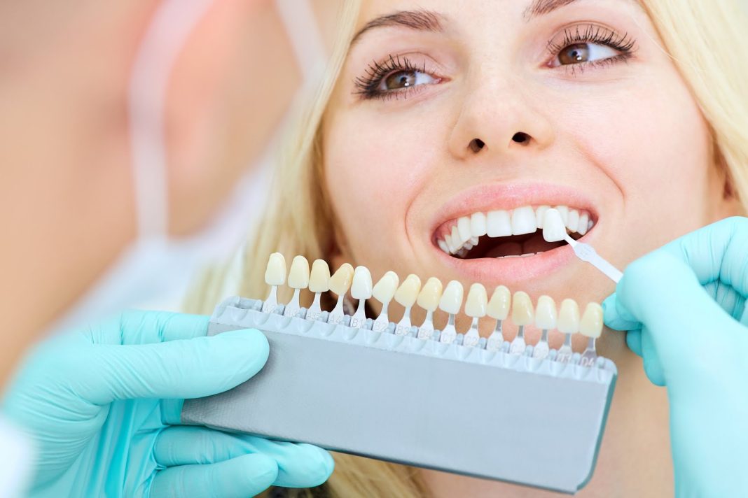How to whiten teeth with lemon and ginger How to whiten teeth with lemon and ginger
