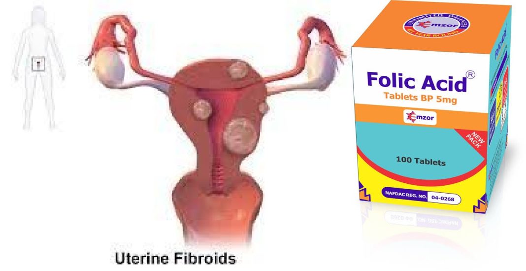 Does folic acid increase the size of fibroid? Does folic acid increase the size of fibroid?