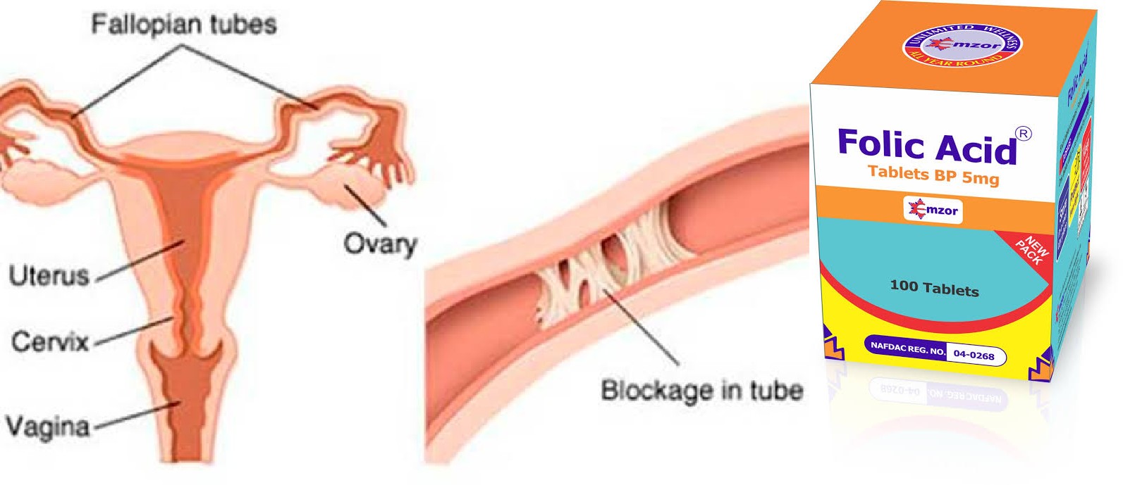 can folic acid unblock fallopian tubes? - Nigerian Health Blog