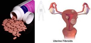 Can prenatal vitamins cause fibroids to grow?