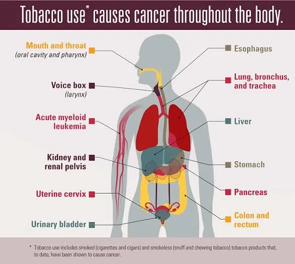 See the List of Cancers Caused by Smoking Images 89
