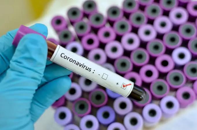 Togo confirms first case of coronavirus.