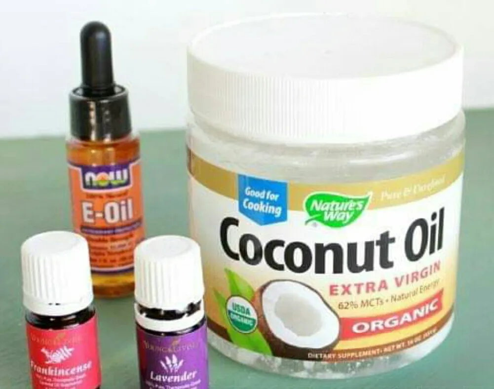 Stretch mark treatment in Nigeria: How to make stretch mark cream in Nigeria? Stretch mark treatment in Nigeria: How to make stretch mark cream in Nigeria?