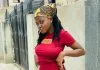 Can a fallen (sagging) breast rise again? Can a fallen breast rise again?