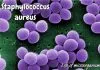 Can bitter leaf cure Staphylococcus aureus? Can bitter leaf cure Staphylococcus aureus?
