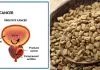 Fenugreek and Enlarged Prostate:Is fenugreek good for prostate cancer?